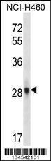 Anti-FGF10 Rabbit Polyclonal Antibody (AP (Alkaline Phosphatase))