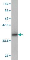 Anti-GLTSCR2 Mouse Monoclonal Antibody [clone: 5A8]