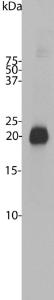 Western blot of bovine cerebellum homogenate stained with Anti-Visinin Like Protein 1 Antibody. Note the strong clean band running at 22 kDa