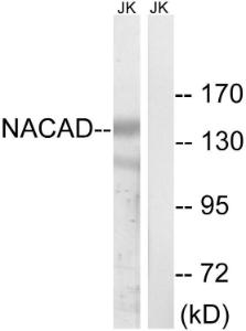 Western blot analysis of lysates from Jurkat cells using Anti-NACAD Antibody. The right hand lane represents a negative control, where the antibody is blocked by the immunising peptide