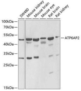 Western blot analysis of extracts of various cell lines, using Anti-Renin Receptor Antibody (A9906) at 1:1,000 dilution