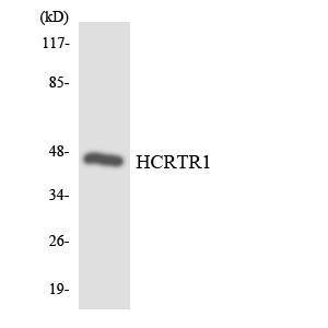 Western blot analysis of the lysates from HepG2 cells using Anti-HCRTR1 Antibody