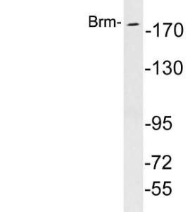 Western blot analysis of lysates from K562 cells using Anti-Brm Antibody