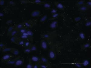 Anti-APOC3 Mouse Monoclonal Antibody [clone: 8H7]