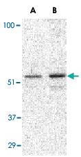 Anti-PLIN3 Rabbit Polyclonal Antibody