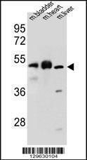 Anti-BTBD17 Rabbit Polyclonal Antibody (HRP (Horseradish Peroxidase))