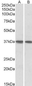 Antibody anti-KLF2 100 µg