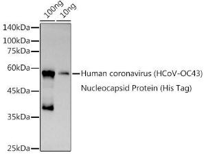 Western blot analysis of extracts of Human coronavirus (HCoV-OC43) Nucleocapsid Protein (His Tag), using Anti-Human Coronovirus Nucleoprotein Antibody (A309268) at 1:1000 dilution. The secondary Antibody was Goat Anti-Rabbit IgG H&L Antibody (HRP) at 1:10000 dilution