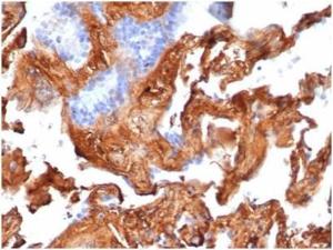 Immunohistochemical analysis of formalin-fixed, paraffin-embedded human lung tissue using Anti-Fibronectin Antibody [FN1/3569]