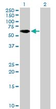 Anti-ZNF777 Mouse Polyclonal Antibody