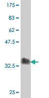 Anti-CLEC4M Mouse Polyclonal Antibody