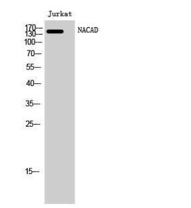 Western blot analysis of Jurkat cells using Anti-NACAD Antibody