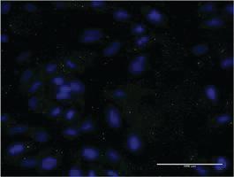 Anti-APOC3 Mouse Monoclonal Antibody [clone: 8H7]