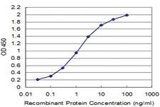 Anti-SSX2 Mouse Monoclonal Antibody [clone: 1A4]