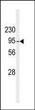 Anti-DGKB Rabbit Polyclonal Antibody (HRP (Horseradish Peroxidase))