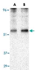 Anti-PLIN3 Rabbit Polyclonal Antibody