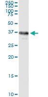 Anti-LCMT1 Polyclonal Antibody Pair