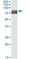 Anti-COX1 Polyclonal Antibody Pair