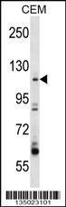 Anti-ARHGEF1 Rabbit Polyclonal Antibody (APC (Allophycocyanin))