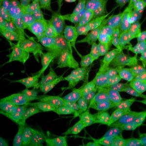 Immunofluorescent analysis of SH-SY5Y cells stained with Anti-UCHL1 Antibody (1:1,000 / green) and Anti-Fibrillarin Antibody (A85370 / 1:1,000 / red). Blue is DAPI staining of nuclear DNA.