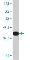 Anti-CLIP2 Mouse Monoclonal Antibody [clone: 3H5]