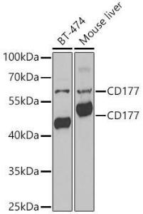 Western blot analysis of extracts of various lysates, using Anti-CD177 Antibody (A9909) at 1:1,000 dilution