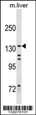 Anti-KIF15 Rabbit Polyclonal Antibody (AP (Alkaline Phosphatase))