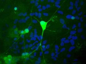 Rat mixed neuron/glial cultures stained with Anti-UCHL1 Antibody (green). Blue is a DNA stain. Note that the Anti-UCHL1 Antibody stains neurons strongly and specifically, and that the staining is concentrated in the cell bodies, though some does extend into the dendrites also.