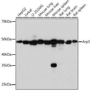 Western blot analysis of extracts of various cell lines, using Anti-Arp3 Antibody [ARC1067] (A306350) at 1:1,000 dilution. The secondary antibody was Goat Anti-Rabbit IgG H&L Antibody (HRP) at 1:10,000 dilution.