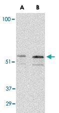 Anti-PAK2 Rabbit Polyclonal Antibody