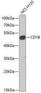 Western blot analysis of extracts of NCI-H125 cells, using Anti-CD1b Antibody (A9910) at 1:1,000 dilution. The secondary antibody was Goat Anti-Rabbit IgG H&L Antibody (HRP) at 1:10,000 dilution.