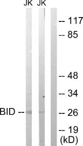 Western blot analysis of lysates from Jurkat cells treated with H2O2 100uM 30' using Anti-BID Antibody The right hand lane represents a negative control, where the antibody is blocked by the immunising peptide