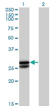 Anti-OSM Mouse Polyclonal Antibody