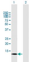 Anti-CNIH3 Mouse Polyclonal Antibody