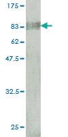 Anti-BTD Mouse Monoclonal Antibody [clone: 3B10-2B3]