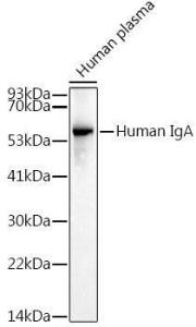 Western blot analysis of extracts of Human plasma, using Anti-Human IgA Antibody [ARC2239] (A305435) at 1:1,000 dilution. The secondary antibody was Goat Anti-Rabbit IgG H&L Antibody (HRP) at 1:10,000 dilution.