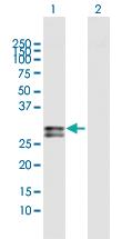 Anti-OSM Rabbit Polyclonal Antibody