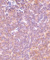 Anti-PAK2 Rabbit Polyclonal Antibody