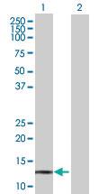 Anti-POLR3K Mouse Polyclonal Antibody