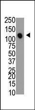 Anti-MTMR4 Rabbit Polyclonal Antibody (FITC (Fluorescein))