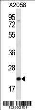 Anti-FGF11 Rabbit Polyclonal Antibody (HRP (Horseradish Peroxidase))