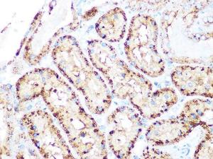 Immunohistochemistry analysis of paraffin-embedded rat kidney using Anti-Arp3 Antibody [ARC1067] (A306350) at a dilution of 1:100 (40x lens). Perform microwave antigen retrieval with 10 mM PBS buffer pH 7.2 before commencing with IHC staining protocol.