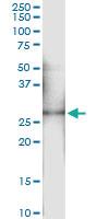 Anti-OSM Rabbit Polyclonal Antibody