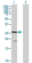 Anti-SSX5 Mouse Polyclonal Antibody