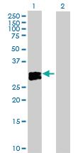 Anti-OSM Rabbit Polyclonal Antibody