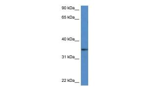 Anti-DHRS3 Rabbit Polyclonal Antibody