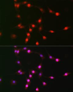 Anti-p19 INK4d antibody