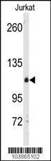 Anti-DGKD Rabbit polyclonal antibody