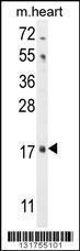 Anti-FGF16 Rabbit Polyclonal Antibody (AP (Alkaline Phosphatase))