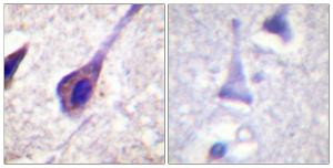 Immunohistochemical analysis of paraffin-embedded human brain using Anti-BID Antibody The right hand panel represents a negative control, where the antibody was pre-incubated with the immunising peptide